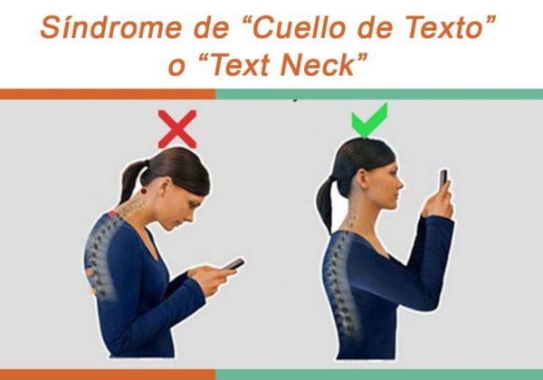 El "text neck" o síndrome de cuello de texto es una de las afecciones más reportadas entre usuarios frecuentes de teléfonos móviles